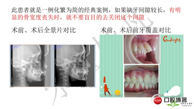 如何避免正畸陷阱！2.jpg_0059.jpg
