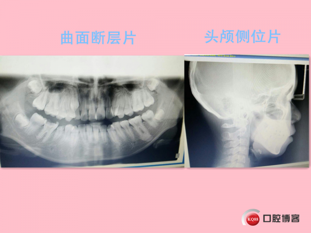 三.jpg