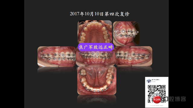IMG_4087.PNG
