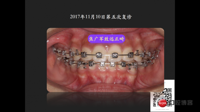 IMG_4090.PNG
