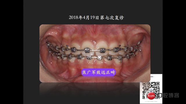 IMG_4098.PNG