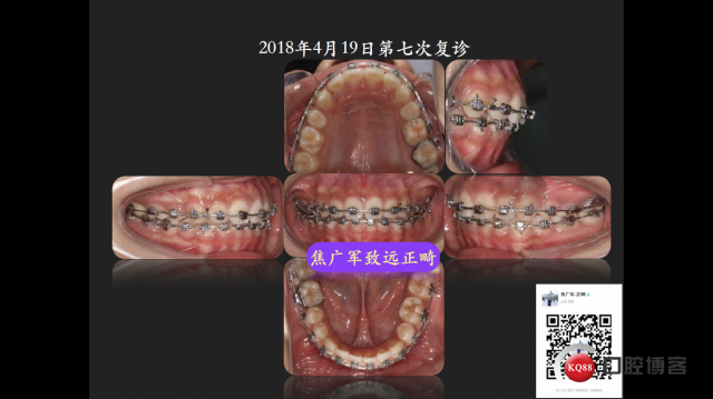 IMG_4099.PNG