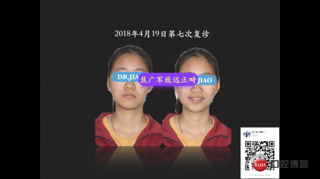 IMG_4100.PNG