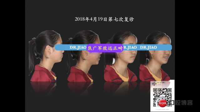IMG_4101.PNG
