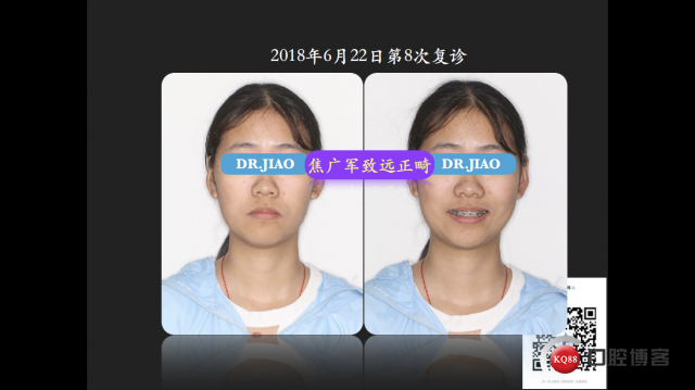 IMG_4104.PNG