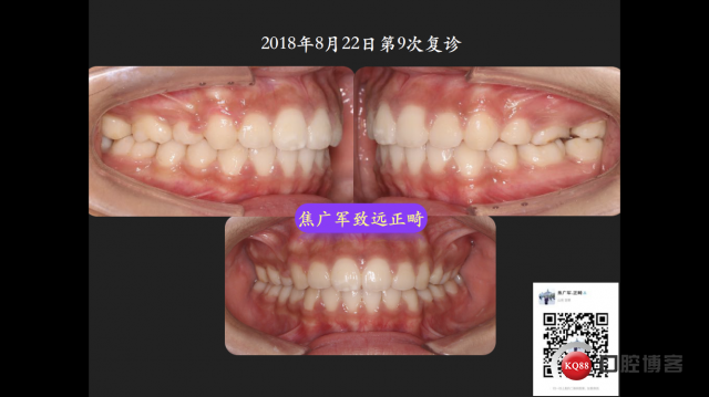 IMG_4109.PNG