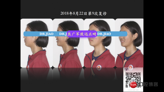 IMG_4113.PNG