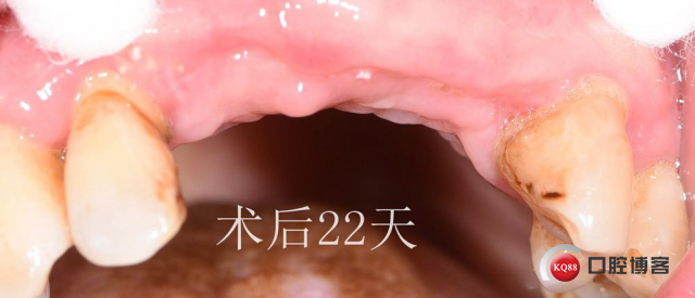 DSC_6519_副本.jpg