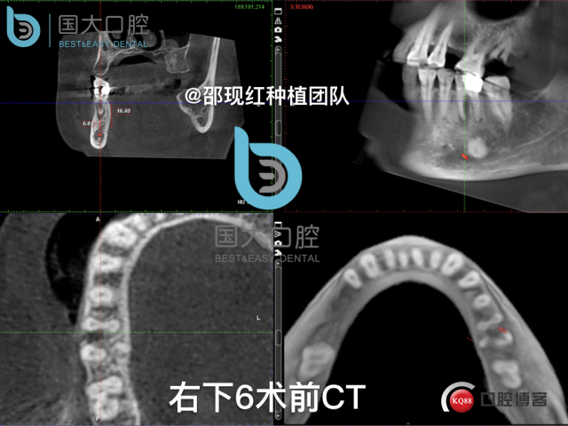 鲍其涓 TypeA.005.jpeg