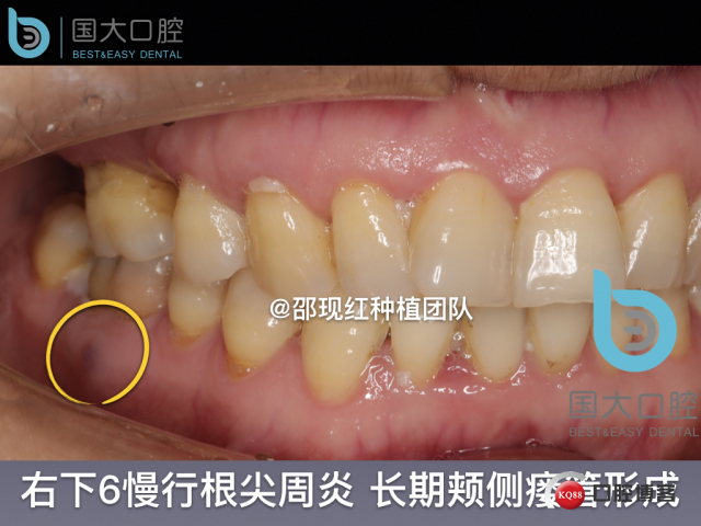 鲍其涓 TypeA.009.jpeg