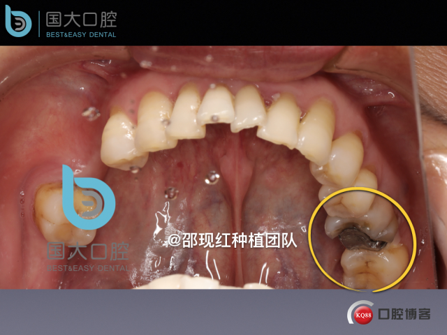鲍其涓 TypeA.010.jpeg