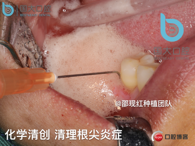 鲍其涓 TypeA.014.jpeg