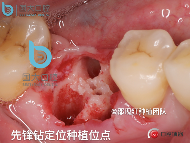 鲍其涓 TypeA.015.jpeg