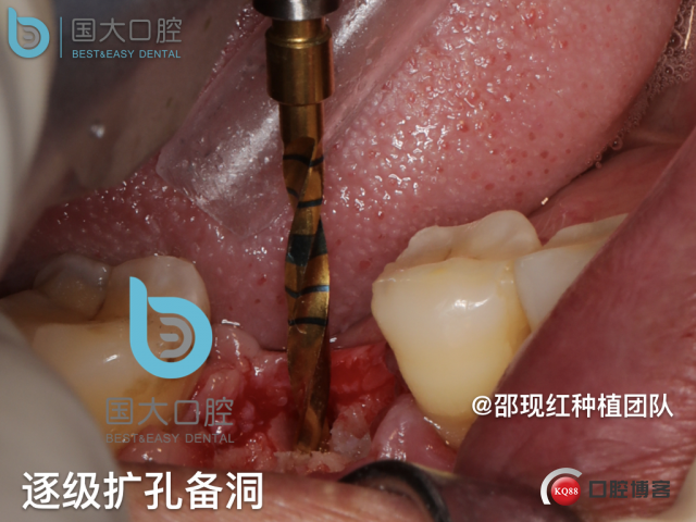鲍其涓 TypeA.016.jpeg