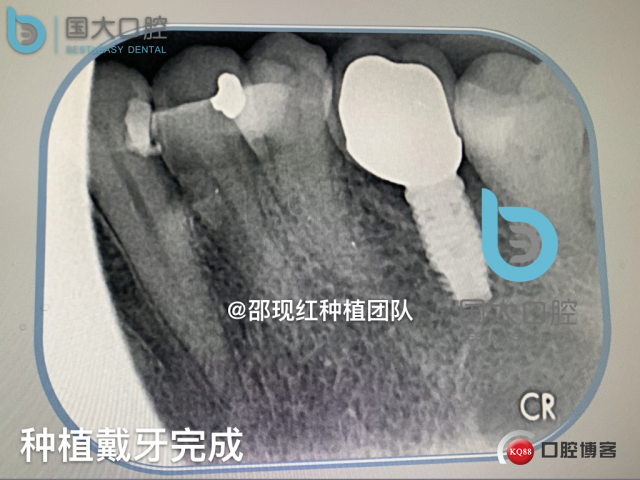 鲍其涓 TypeA.025.jpeg