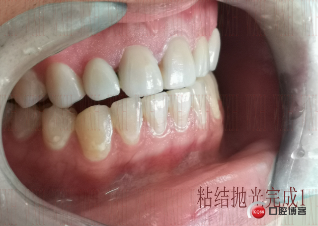 粘结抛光完成1 复制.jpg