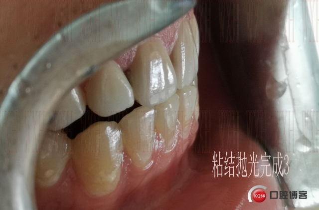 粘结抛光完成3 复制.jpg