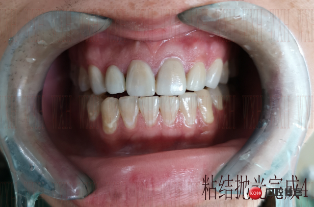 粘结抛光完成4 复制.jpg