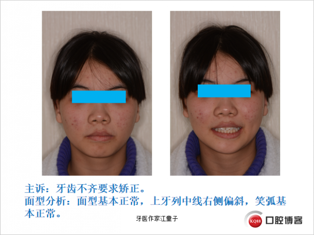 盛凤霞1.png