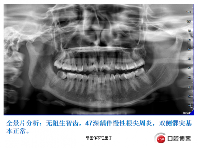 盛凤霞2.png