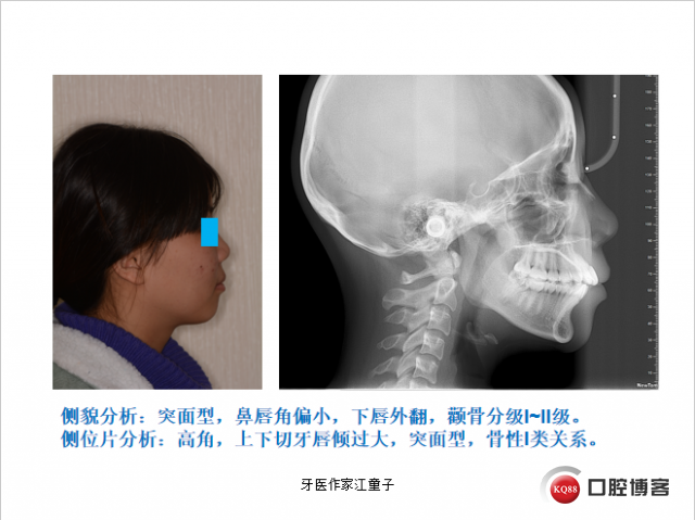 盛凤霞3.png