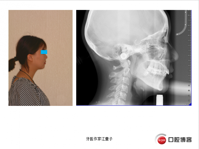 盛凤霞8.png
