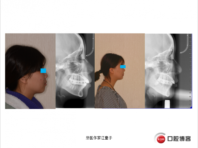 盛凤霞12.png