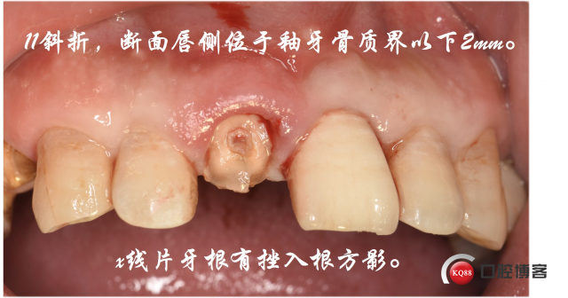 即刻3.jpg