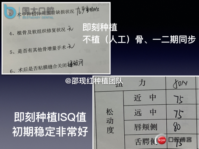 来澜 左下6标准即刻种植 sic 瘘管.025.jpeg