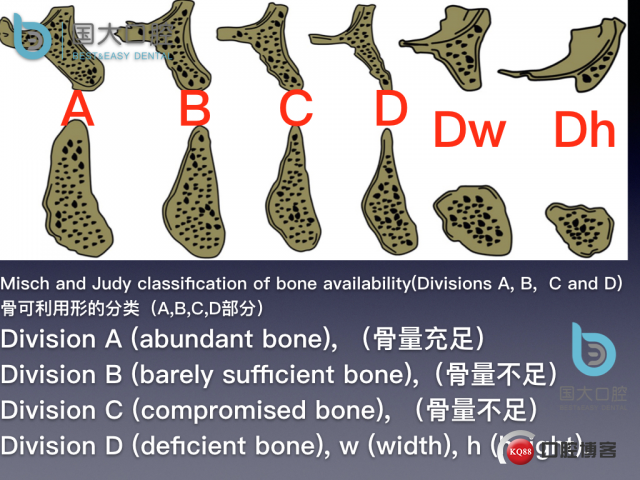 王月秀 下颌种植四颗 下颌骨严重萎缩.013.jpeg