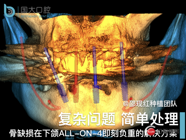 徐伏根 发布.001.jpeg