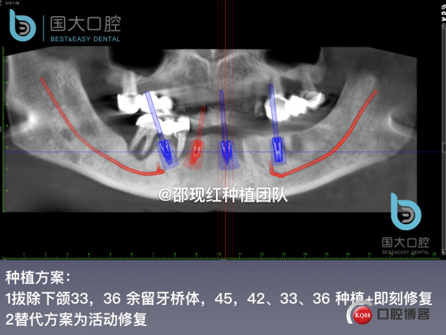 徐伏根 发布.015.jpeg