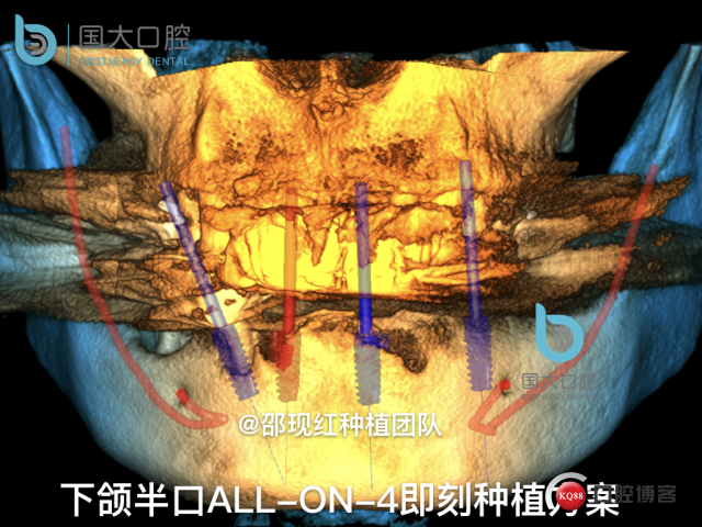 徐伏根 发布.018.jpeg