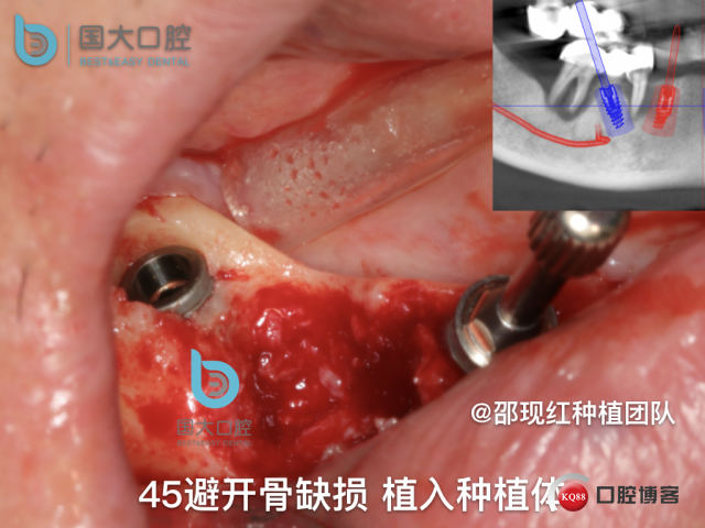 徐伏根 发布.030.jpeg