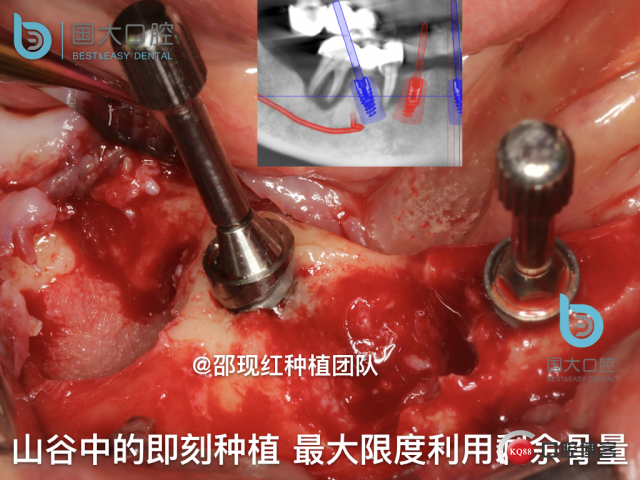 徐伏根 发布.031.jpeg