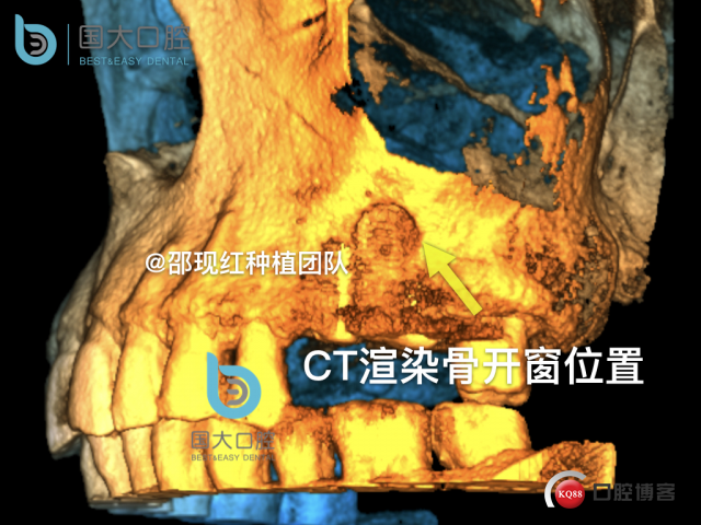 陈建东.030.jpeg