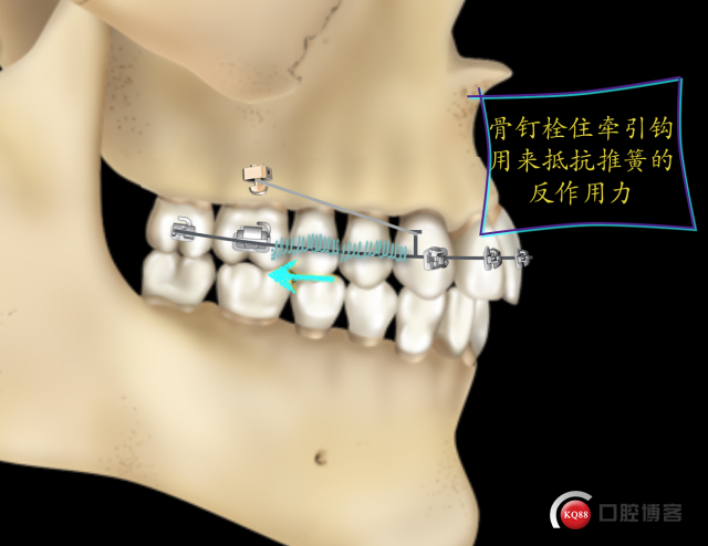 WX20200107-210909@2x.png