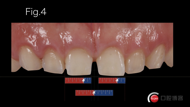 veneers  CASE_Styleitaliano_的副本2.014.jpeg