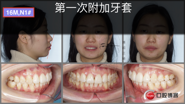 刘欢，推磨牙图片输出.035.jpeg