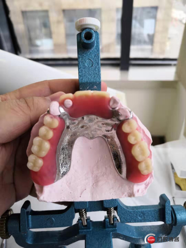 技工排牙3.jpg