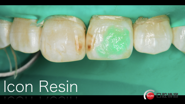 Icon resin .009.jpeg