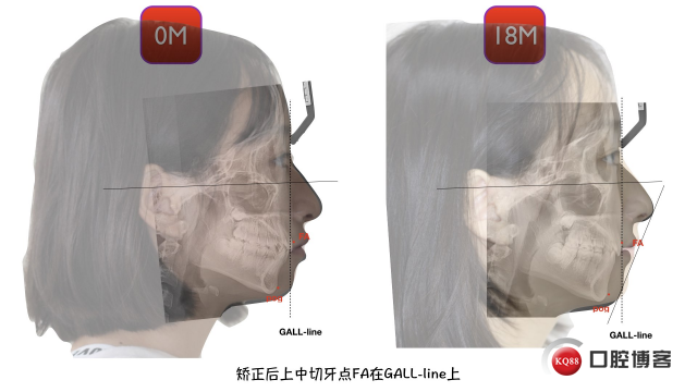 董子昕key.034.jpeg
