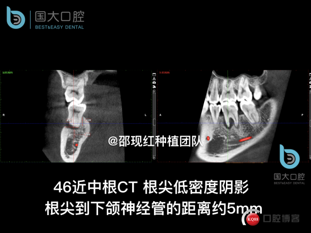 卢林 .006.jpeg