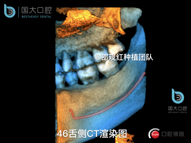 卢林 .009.jpeg