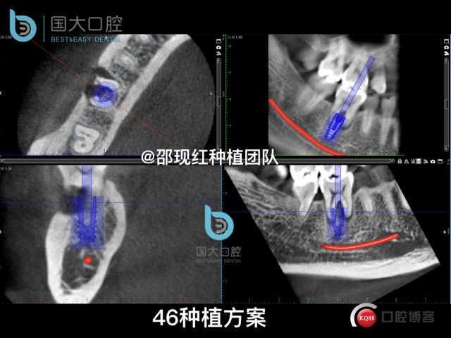 卢林 .013.jpeg