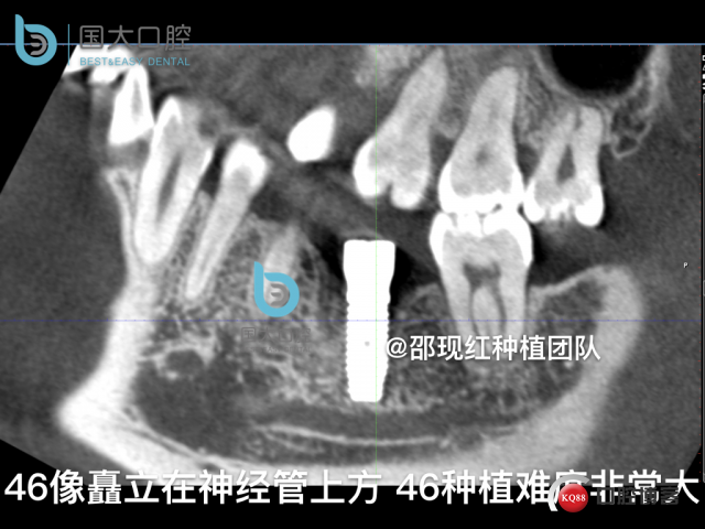 卢林 .030.jpeg
