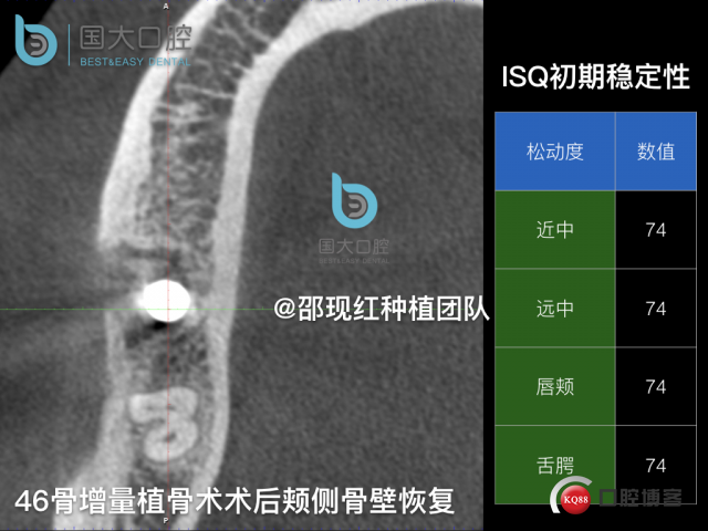卢林 .031.jpeg