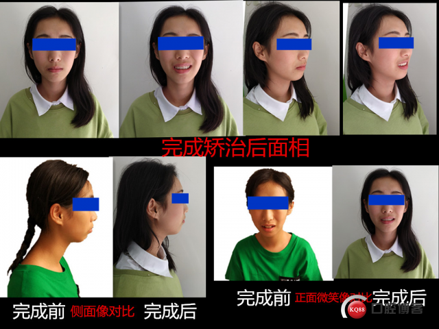 十一.jpg