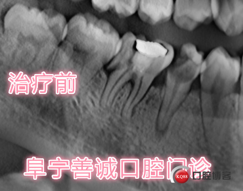 美图治疗前.jpg