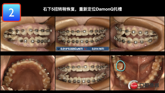 “insignia1号，涂雯丽”最终版 输出.023.jpeg